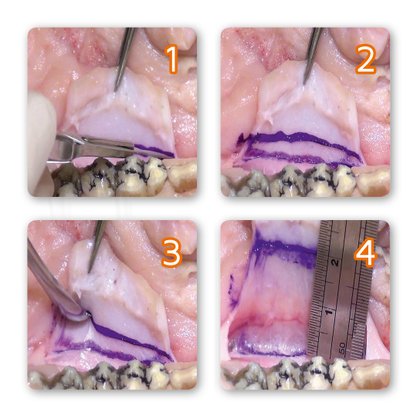 Extensor de Retalho WEN Tension Release Comb HZepf