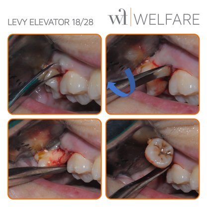 Levy Elevator 18-28 Schwert para Terceiros Molares
