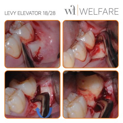 Levy Elevator 18-28 Schwert para Terceiros Molares